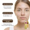 TCM Scar And Acne Mark Removal Gel Ointment - 30g - Image 6
