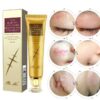 TCM Scar And Acne Mark Removal Gel Ointment - 30g - Image 5