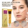 TCM Scar And Acne Mark Removal Gel Ointment - 30g - Image 4