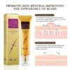 TCM Scar And Acne Mark Removal Gel Ointment - 30g - Image 2