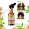 Disaar -Ginger Anti Hairloss Oil 30g - Image 3