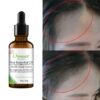Disaar - Anti Hairloss Essential oil 30g x 2 - Image 3
