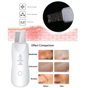 Rechargeable Facial Skin Scrubber